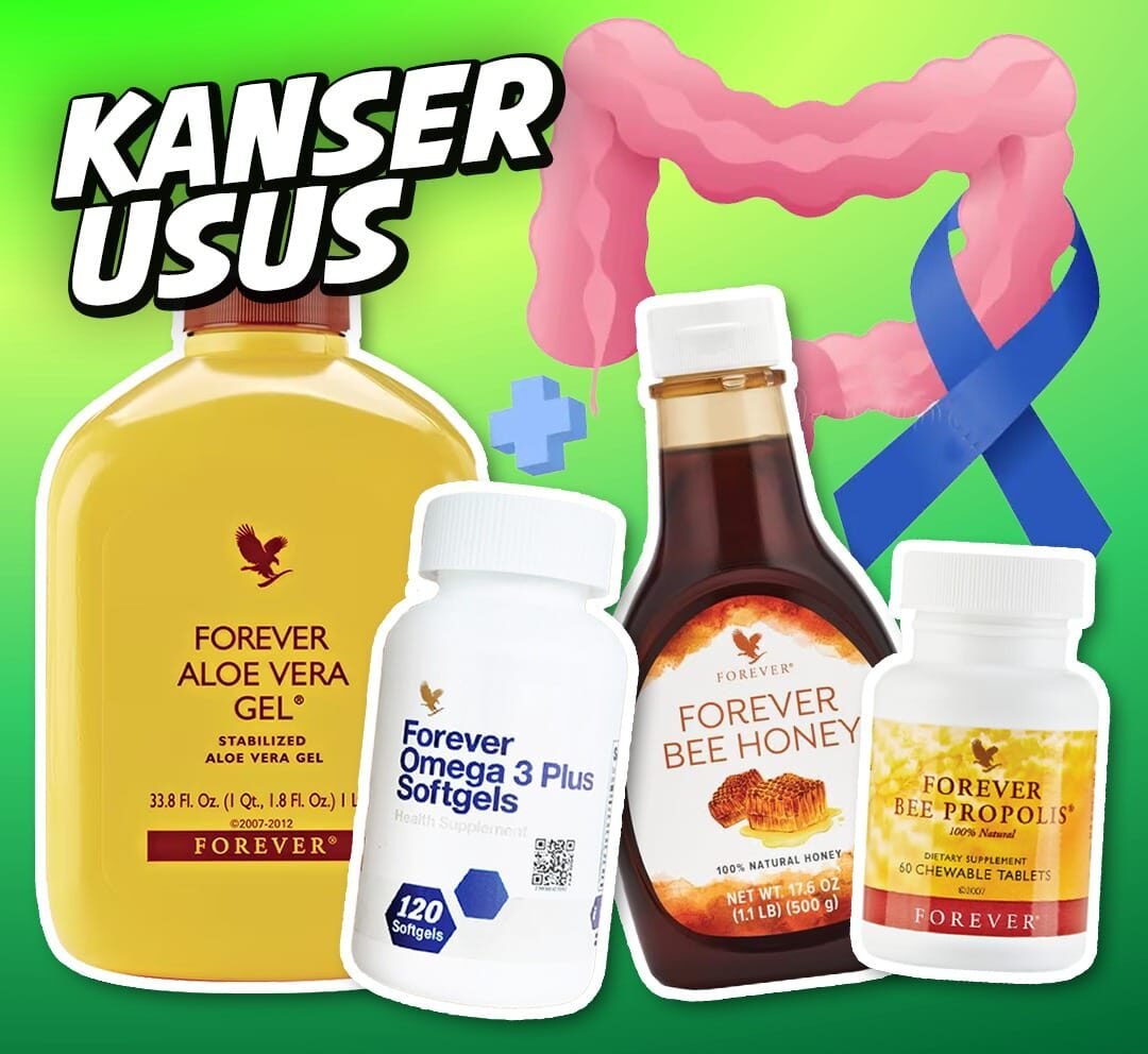 Rujukan set popular - Kanser Usus